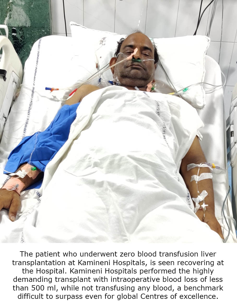 Kamineni Hospitals creates history with a zero blood   transfusion liver transplant, limits blood loss!